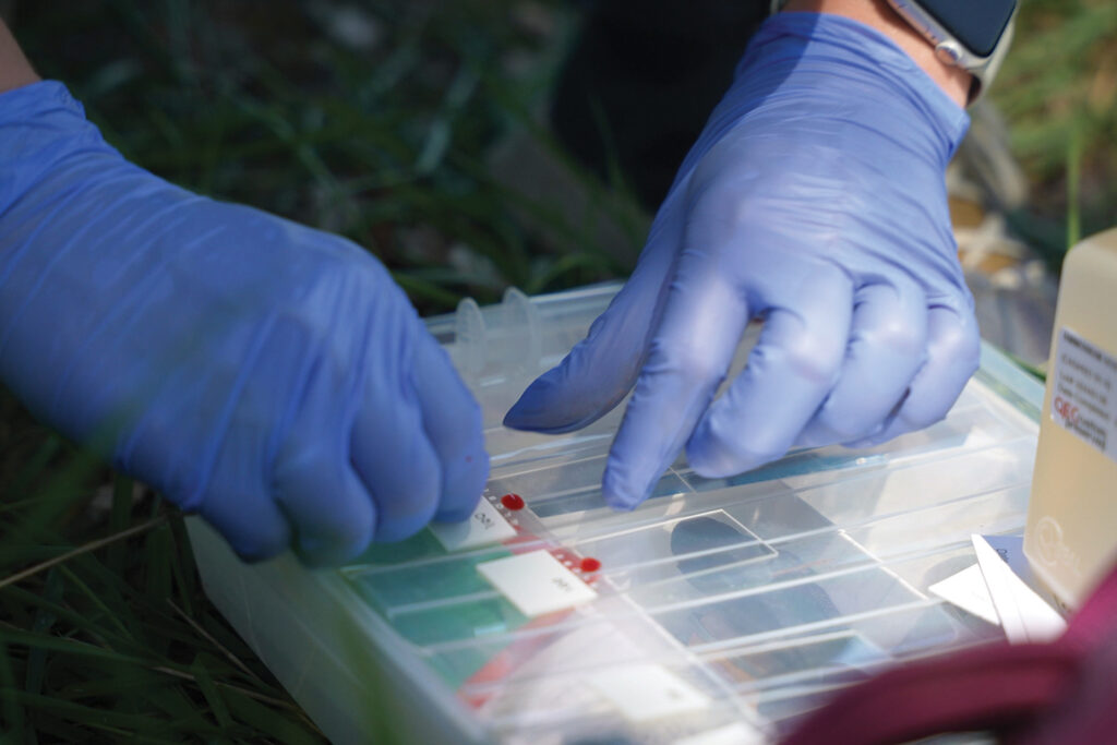 Gloved hands holding glass slides with single drops of red blood on them over a container of glass slides.
